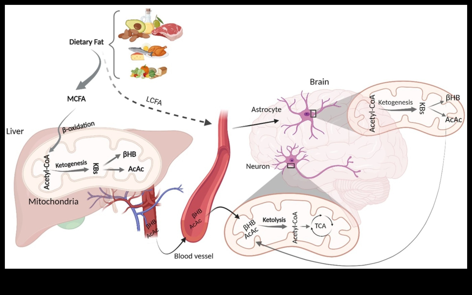 Ketonların Beyin Sağlığındaki Rolü: Derinlemesine Bir İnceleme